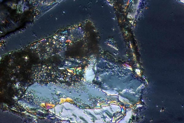 40x Hoffman Modulation Contrast with polarization stack with Zerene Stacker DMap stack of 7 images